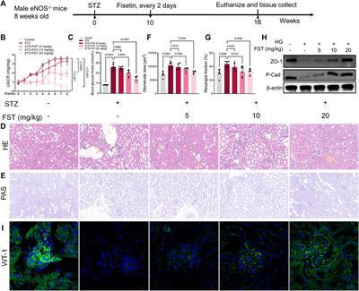 Fisetin Attenuates Diabetic Nephropathy-Induced Podocyte Injury by Inhibiting NLRP3 Inflammasome